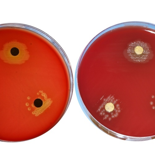 Képek a mikrobiológiai laboratóriumból 