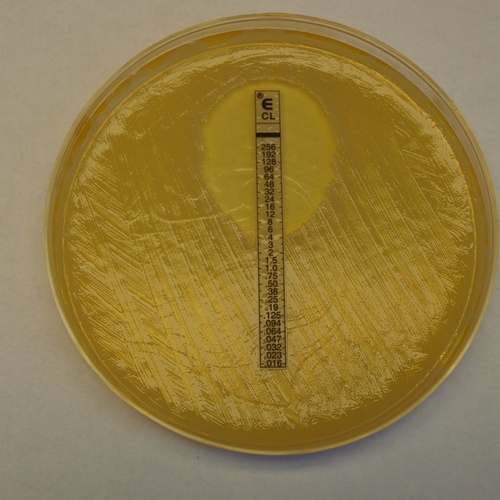 Képek a mikrobiológiai laboratóriumból 
